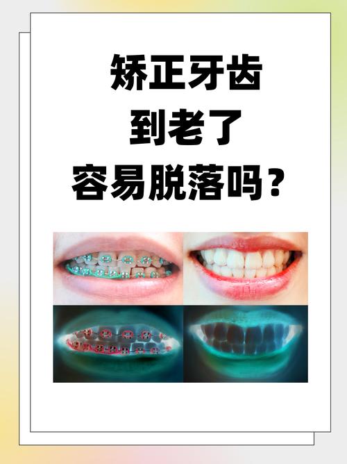 牙齿矫正真的会导致掉牙吗?-图1 牙齿矫正真的会导致掉牙吗?-图1