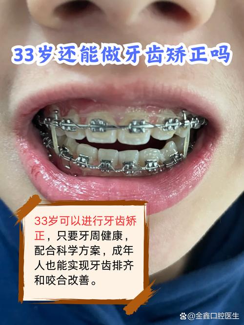 33岁做牙齿矫正，现在开始会不会太晚？效果和年轻人一样吗？-图2