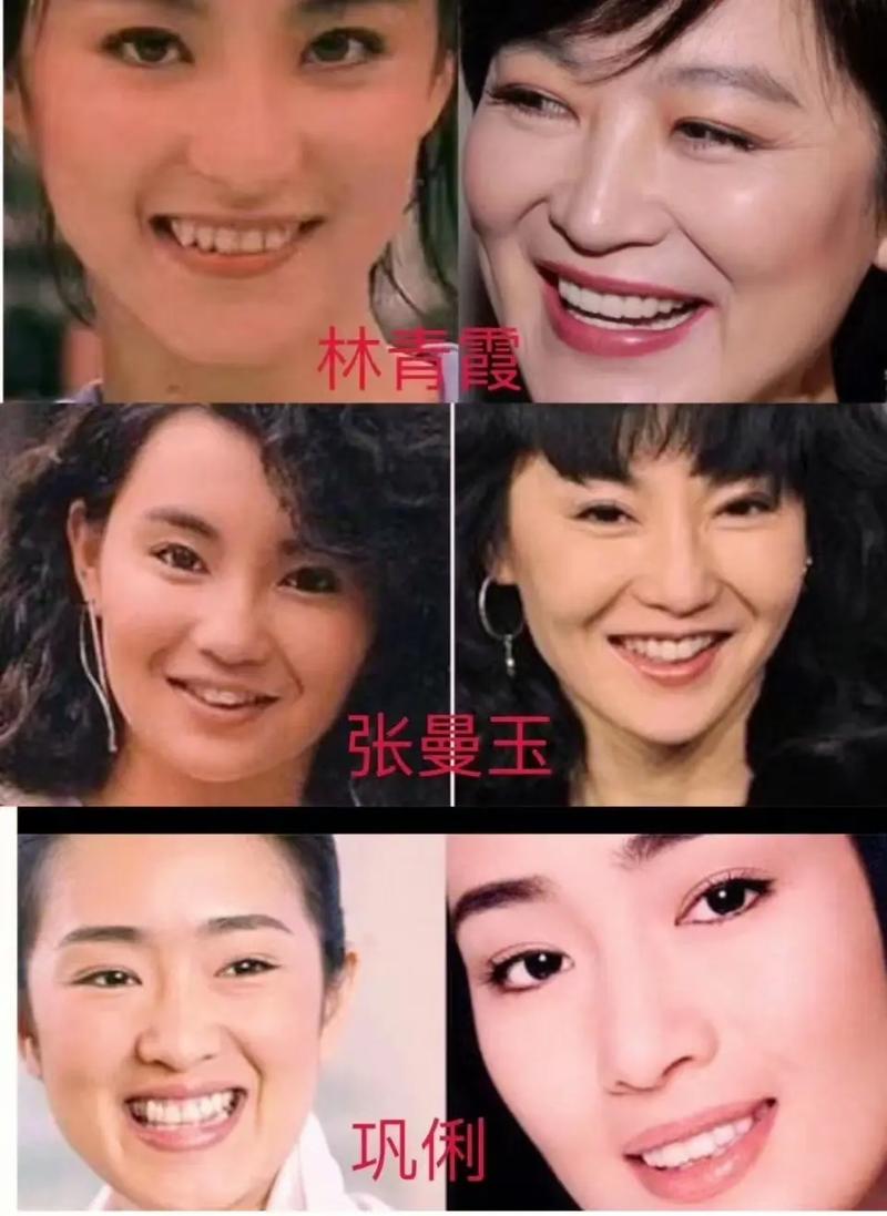 为何成年明星纷纷选择矫正牙齿?年龄是影响因素吗?-图2 为何成年明星纷纷选择矫正牙齿?年龄是影响因素吗?-图2