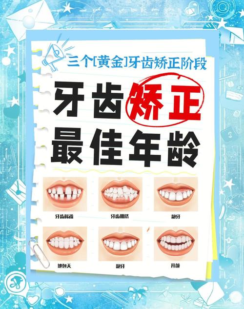 南京矫正牙齿的最佳年龄范围是多少？-图3