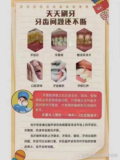 牙齿矫正期间，需要洗牙吗？-图1