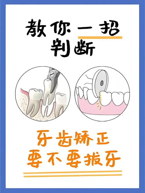 矫正牙齿为什么一定要拔牙?-图3 矫正牙齿为什么一定要拔牙?-图3
