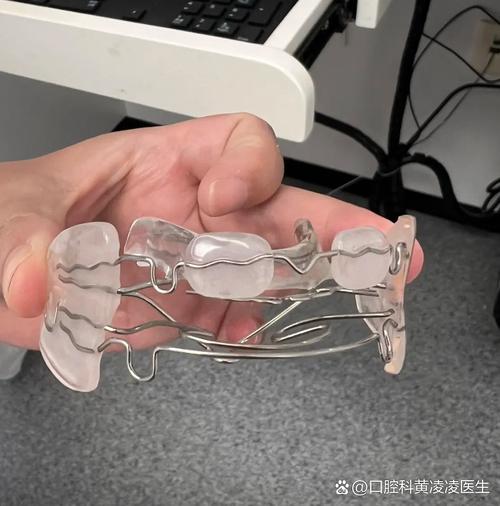 颞颌关节牙齿矫正-图1