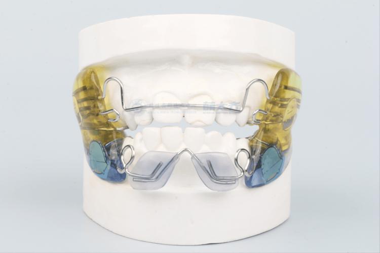 功能性牙齿矫正器，与传统矫正有何不同？-图2
