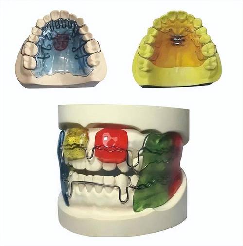 功能性牙齿矫正器，与传统矫正有何不同？-图3