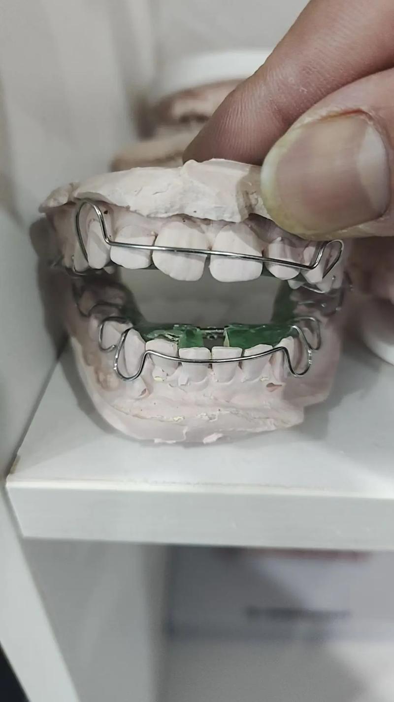 口腔诊所牙齿矫正-图3 口腔诊所牙齿矫正-图3