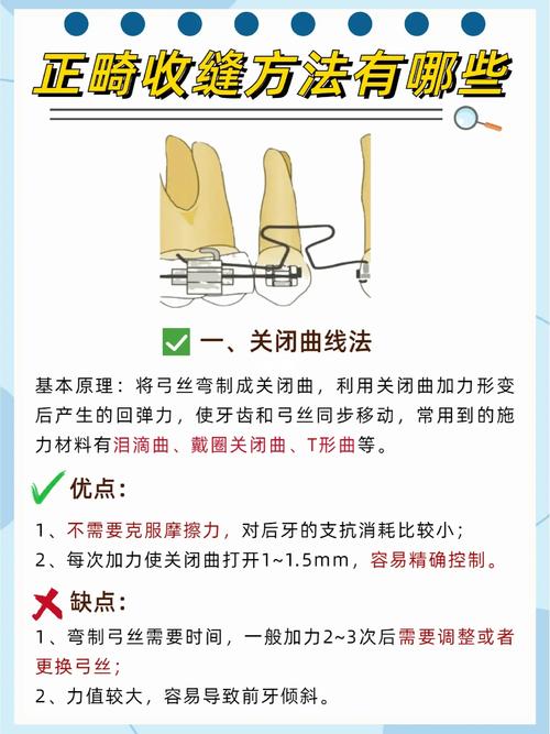 牙齿矫正收缝怎么收？步骤、时间及方法全解析-图1