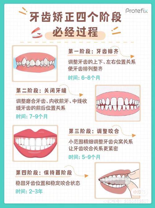 牙齿矫正的变化过程具体会经历哪些关键阶段和变化步骤？-图2