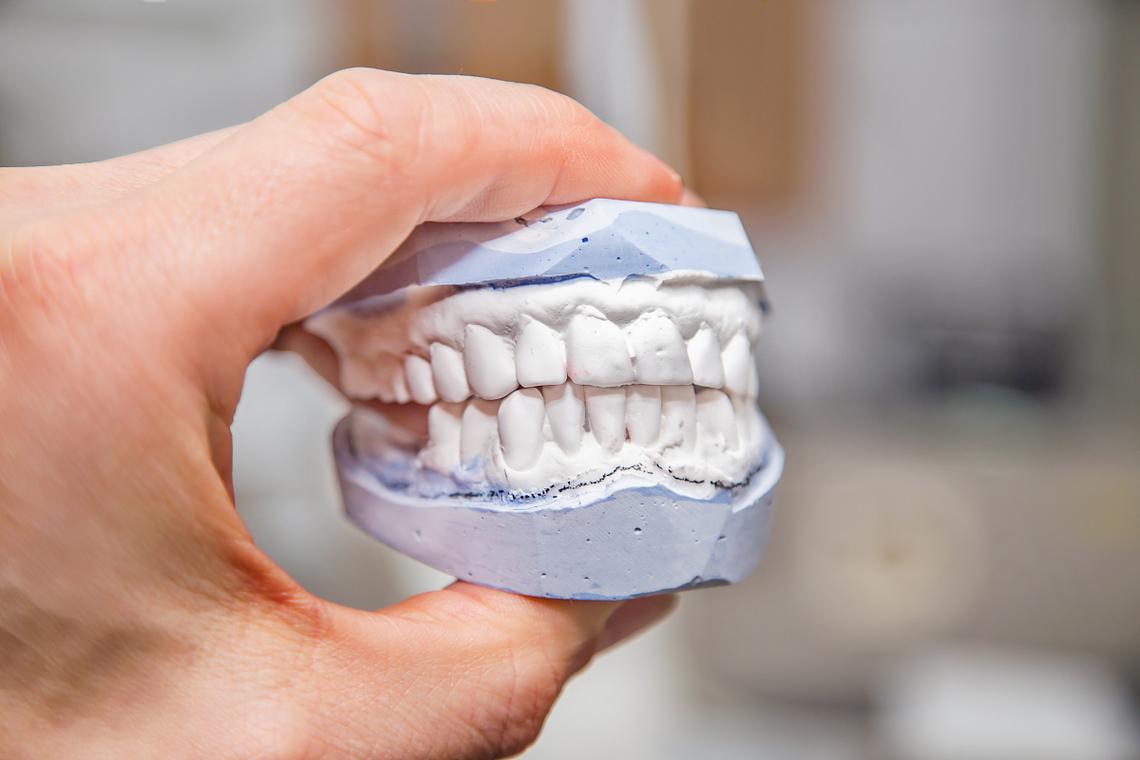 矫正牙齿睡觉磨牙-图2