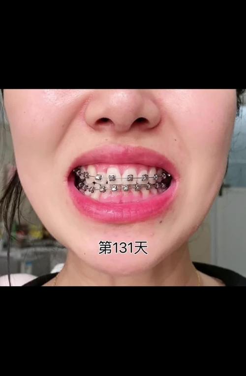 大连矫正牙齿好的，哪家医院正畸靠谱？-图1