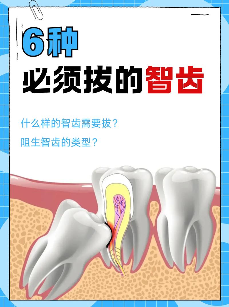 矫正牙齿拔智齿吗-图2
