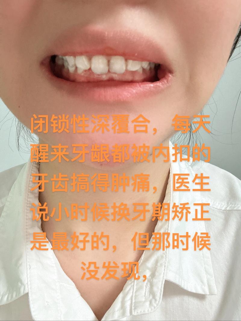 矫正牙齿真的会有后遗症吗？影响大不大？-图3