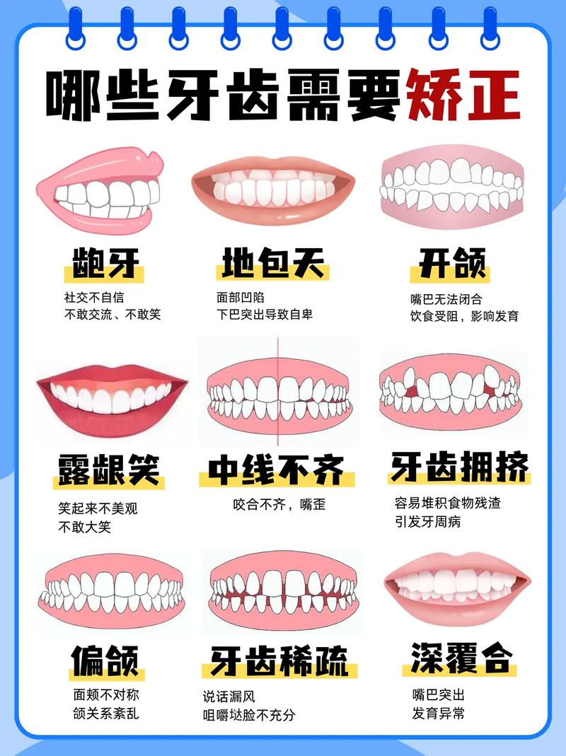 哪些牙齿问题需要矫正?这些情况别忽视!-图2 哪些牙齿问题需要矫正?这些情况别忽视!-图2