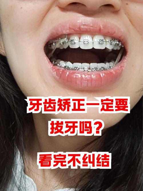 牙齿矫正会很痛吗-图1 牙齿矫正会很痛吗-图1