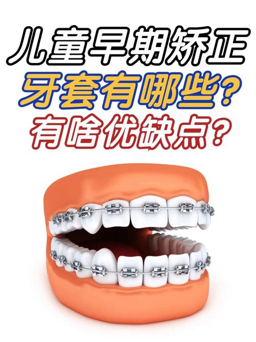 牙套可以矫正牙齿-图2