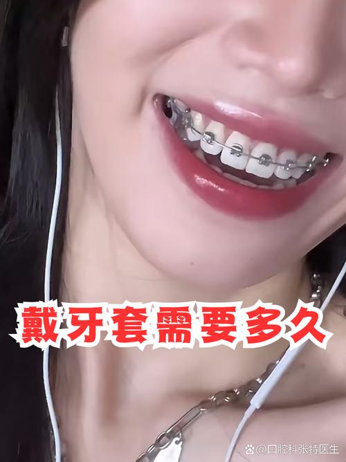 牙套可以矫正牙齿-图3