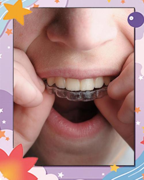 12岁是牙齿矫正的黄金时期吗？矫正效果如何？-图2