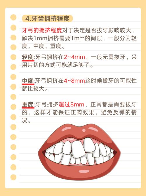 矫正牙齿拔牙数量怎么定？一般需要拔几颗合适？-图3