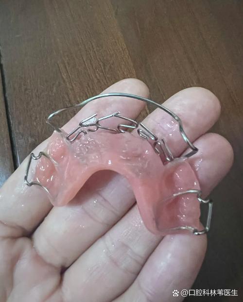 牙齿矫正与烤瓷牙能同时做吗？效果会如何？-图1