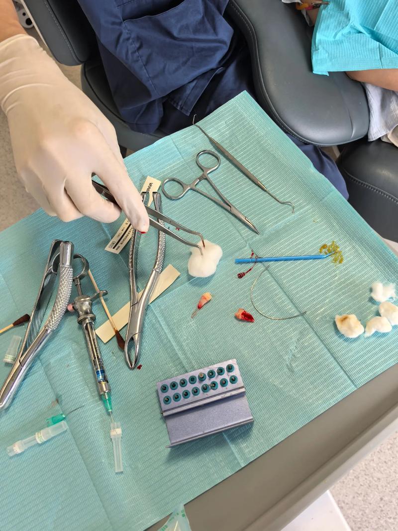 矫正牙齿和拔智齿，到底该先做哪个？顺序有讲究吗？-图2