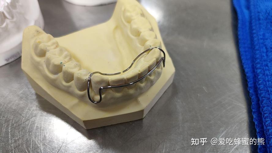 牙齿矫正弓丝弯制-图2 牙齿矫正弓丝弯制-图2