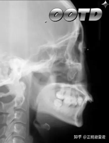 北京圣贝牙齿矫正-图2