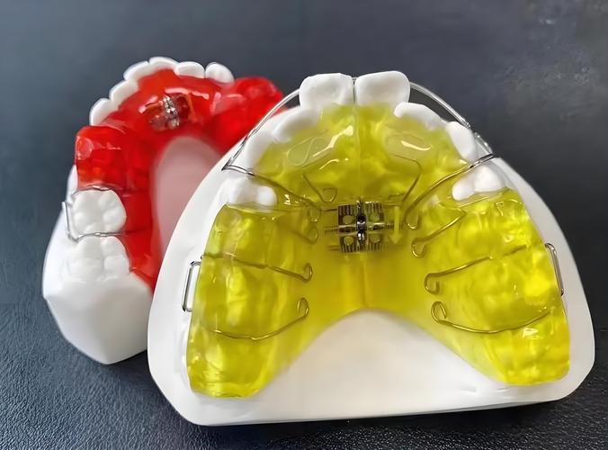 牙齿矫正器有哪些常见类型？-图2