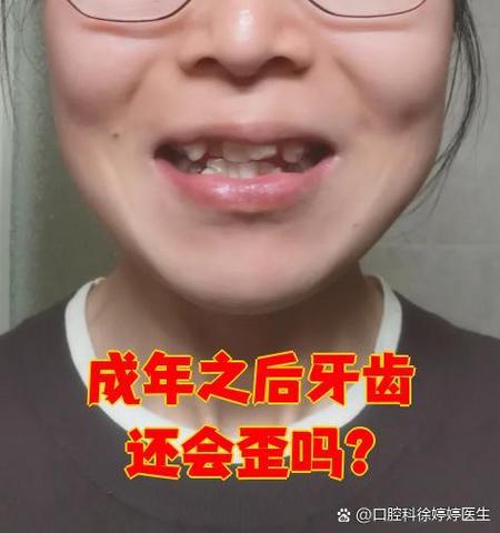 牙齿矫正后为何又歪了？反弹原因与解决方法详解？-图1