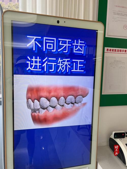 宁波二院牙齿矫正-图3 宁波二院牙齿矫正-图3