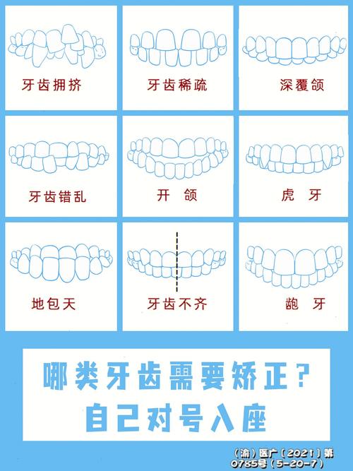 牙齿矫正术费用多少?不同矫正方式价格差异有多大?-图3 牙齿矫正术费用多少?不同矫正方式价格差异有多大?-图3