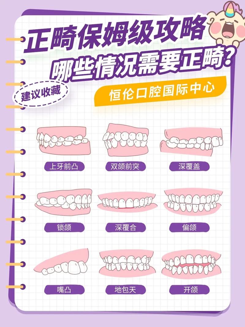 牙齿要不要矫正？关键看是否影响健康和美观！-图3