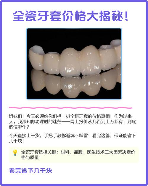 陶瓷牙齿矫正价格多少？影响因素有哪些？-图1