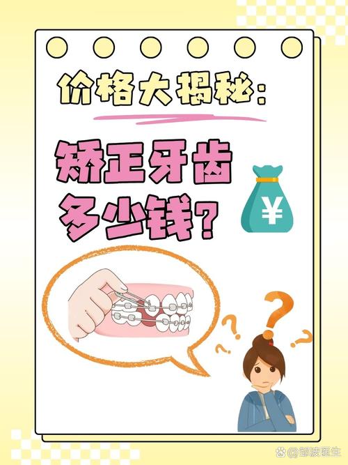 成人矫正牙齿价格多少？差异大的原因是什么？-图3