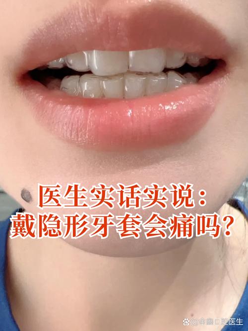 隐形矫正牙齿好吗-图1 隐形矫正牙齿好吗-图1