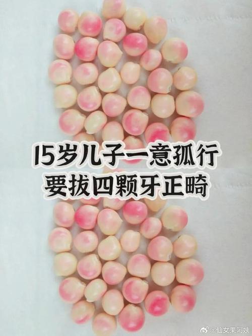 牙齿矫正拔四颗牙-图3