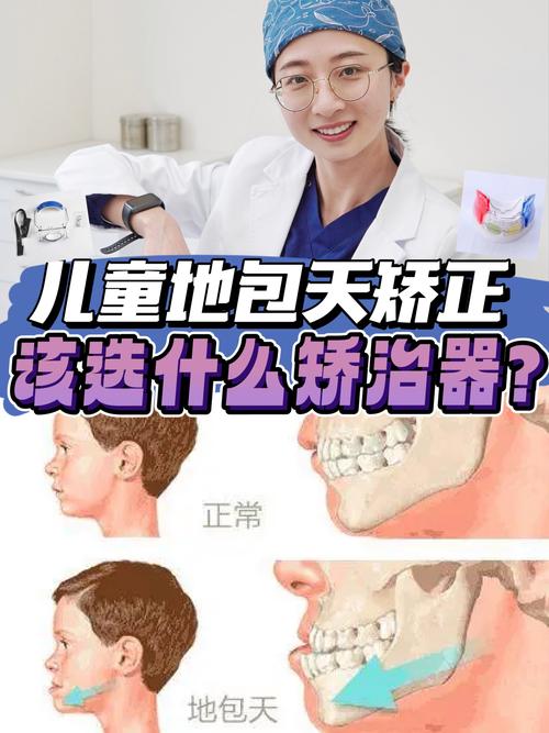 儿童牙齿反颌矫正-图2 儿童牙齿反颌矫正-图2