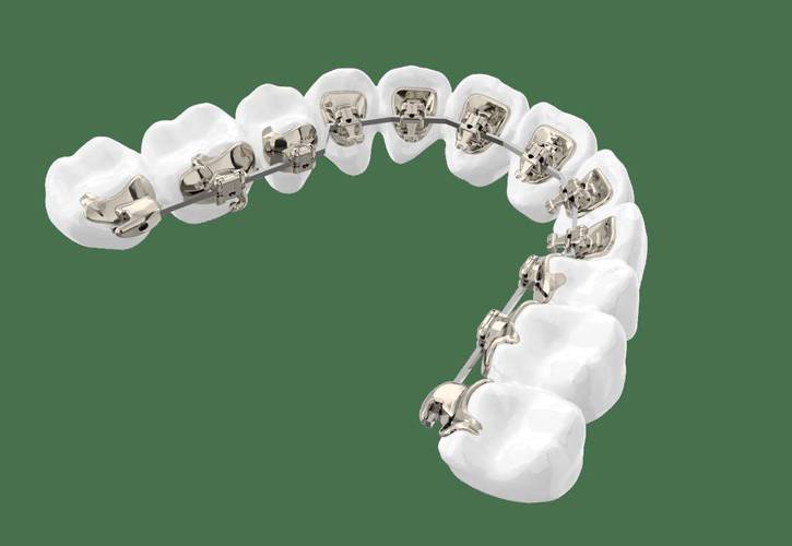 舌头和牙齿矫正-图2 舌头和牙齿矫正-图2