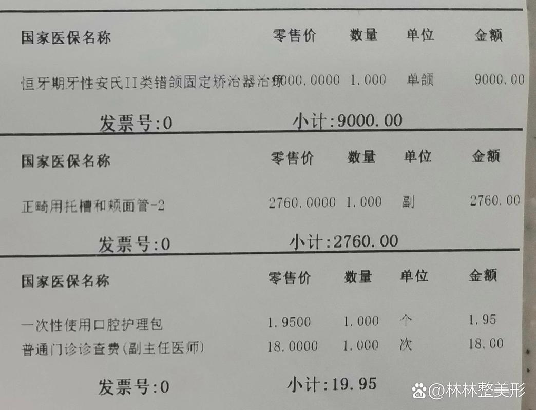 矫正牙齿病历图-图3