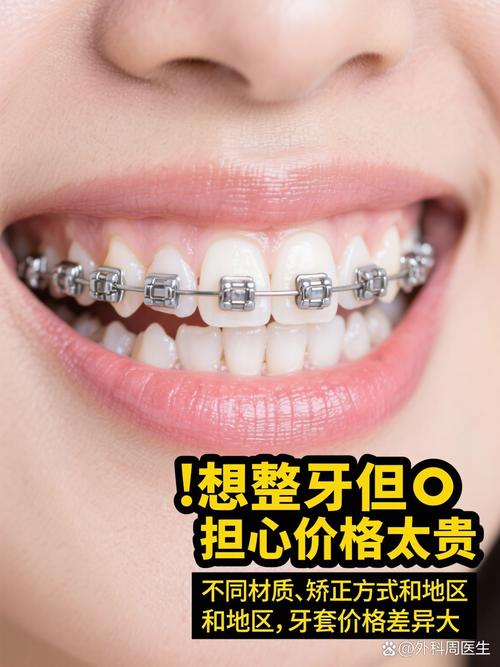 最新牙齿矫正套矫正效果真的比传统方式更好吗?-图1 最新牙齿矫正套矫正效果真的比传统方式更好吗?-图1
