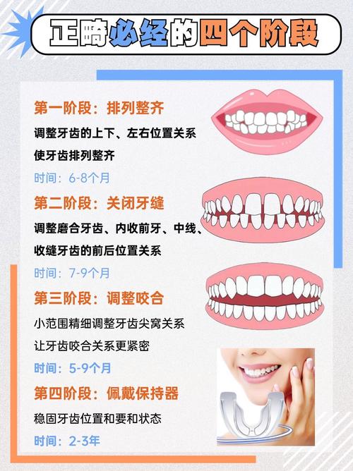 牙齿矫正的最佳时机是什么时候?不同年龄有差异吗?-图2 牙齿矫正的最佳时机是什么时候?不同年龄有差异吗?-图2