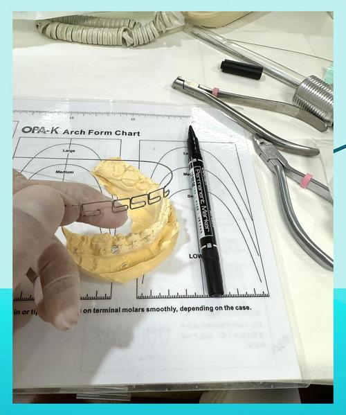 真丝弓牙齿矫正有何优势？效果如何？适合哪些情况？-图1