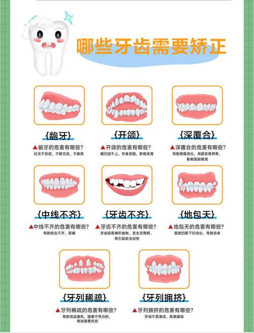 矫正牙齿的词语有哪些？专业术语与日常说法有何区别？-图1