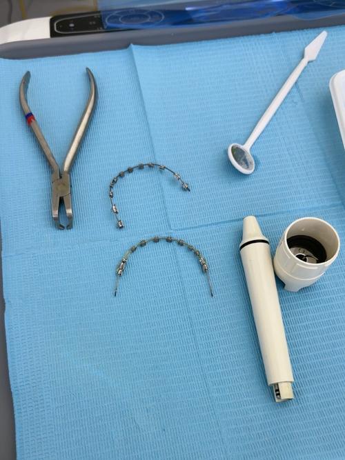 牙齿矫正拆钉子-图2