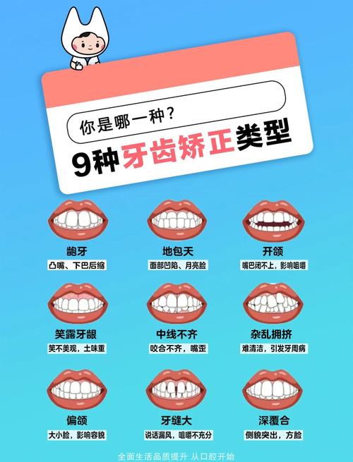 牙齿矫正有哪些类型？哪种更适合自己？-图1