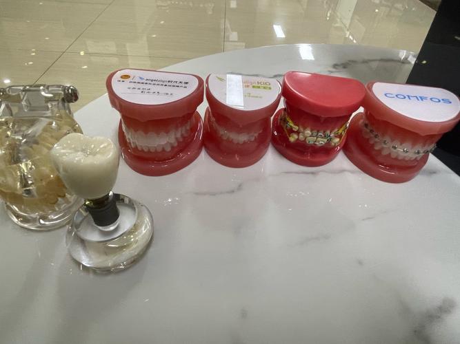 爱康健牙齿矫正效果如何?过程痛苦吗?能维持多久?-图3 爱康健牙齿矫正效果如何?过程痛苦吗?能维持多久?-图3