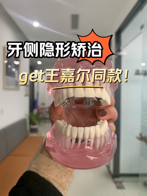 牙齿矫正 打孔-图3 牙齿矫正 打孔-图3