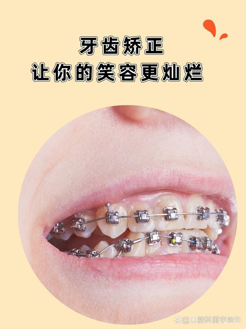 牙齿矫正 值得-图1