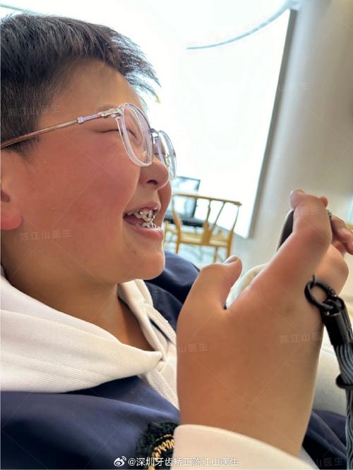 矫正牙齿 笑容-图2