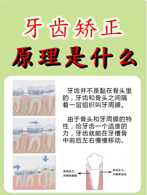 牙齿知识 矫正-图2