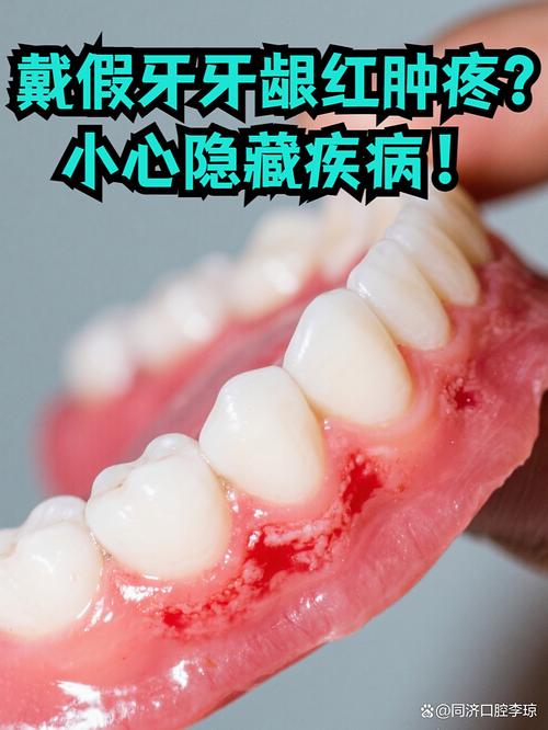 矫正期间牙齿痛是为什么？怎么缓解才有效？-图2